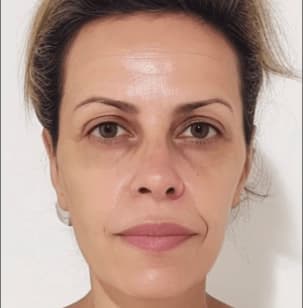 Foto de progresso: Dia 1