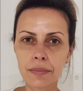 Foto de progresso: Dia 30